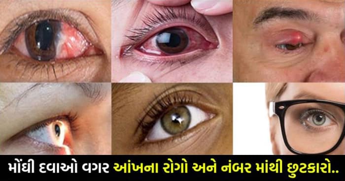 મોંઘી દવાઓ વગર દરેક પ્રકારના આંખના રોગો અને નંબર માંથી છુટકારો અપાવશે આ સરળ ઉપચાર..