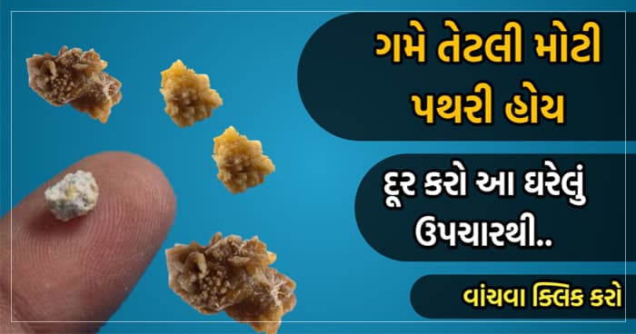 પથરીનું ઓપરેશન કરાવતા પહેલા અપનાવો આ ઘરેલું ઉપચાર, કદાચ તમારે ઓપરેશન નહીં કરાવવું પડે…
