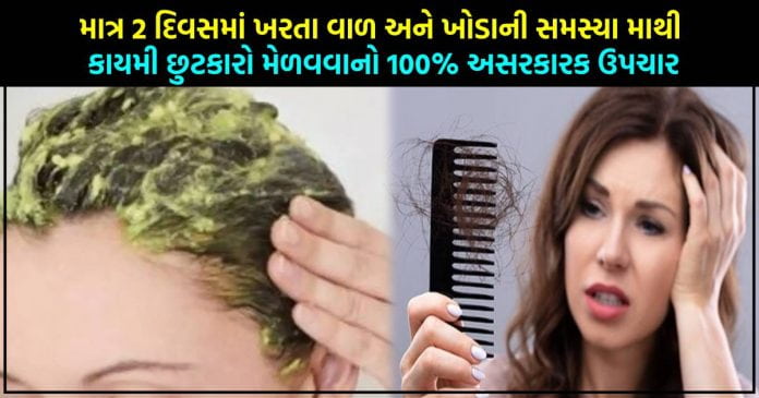 માત્ર 2 દિવસમાં ખરતા વાળ અને ખોડાની સમસ્યા માથી કાયમી છુટકારો મેળવવાનો 100% અસરકારક ઉપચાર..