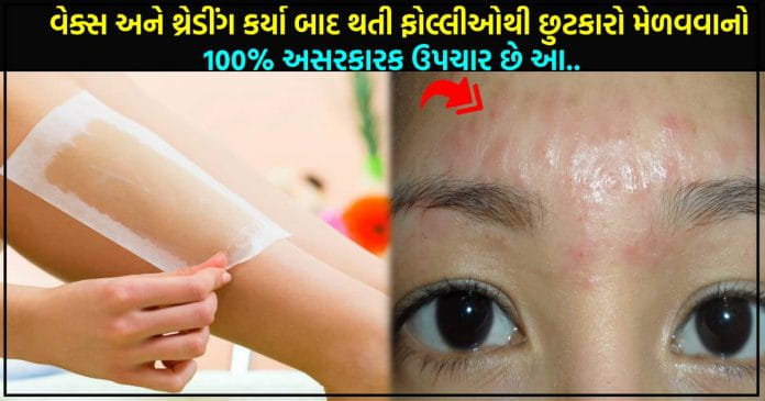 વેક્સ અને થ્રેડીંગ કર્યા બાદ થતી ફોલ્લીઓથી છુટકારો મેળવવાનો 100% અસરકારક ઉપચાર..