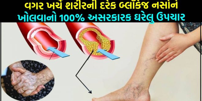 વગર ખર્ચે શરીરની દરેક બ્લૉકેજ નસોને ખોલવાનો 100% અસરકારક ઘરેલુ ઉપચાર