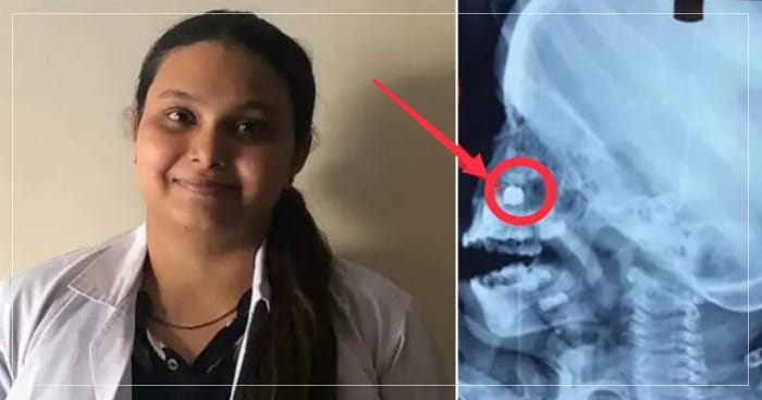 રમત રમતમાં સાડા ત્રણ વર્ષના નાના બાળકે નાકમાં નાંખી દીધી એવી વસ્તુ કે પરિવાર ના લોકોનો જીવ તાળવે ચોંટી ગયો..