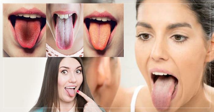 જીભના રંગથી જાણો સ્વાસ્થ્યની સ્થિતિ, જો તમને આવા લક્ષણો દેખાય તો થઈ જાવ સાવધાન