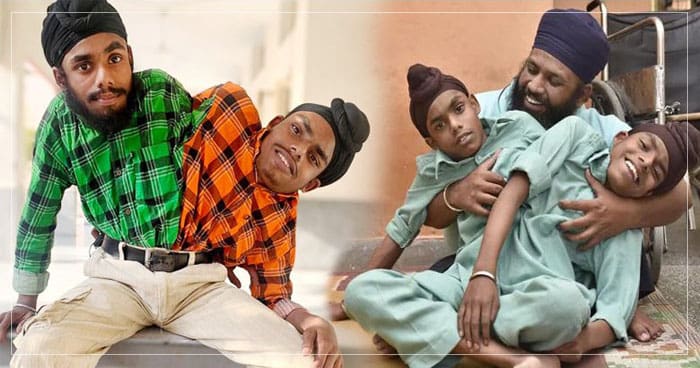 અશક્યને પણ પાછળ છોડીને આગળ વધ્યું ‘એક શરીર બે જીવ’ ના નામથી બોલાવવામાં આવે છે સોહના-મોહના..