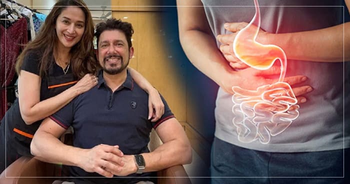 માધુરી દીક્ષિતના પતિ નેને એ એસિડિટી અને ખાટા ઓડકારથી બચવાની ટિપ્સ શેર કરી, કહ્યું- આ વસ્તુઓથી દૂર રહો