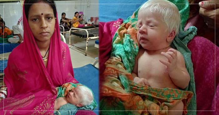 ભારતના આ રાજ્યમાં થયો ‘અંગ્રેજી બાળક’નો જન્મ, ડોક્ટરે કહ્યું લાખોમાં એક જ હોય છે આવા કેસ..