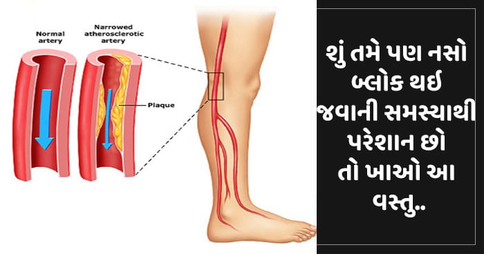 શું તમે પણ નસો બ્લોક થઇ જવાની સમસ્યાથી પરેશાન છો તો ખાઓ આ વસ્તુ, નસોનું ફુલાવું વગેરે સમસ્યાઓથી મેળવી શકો છો છુટકારો