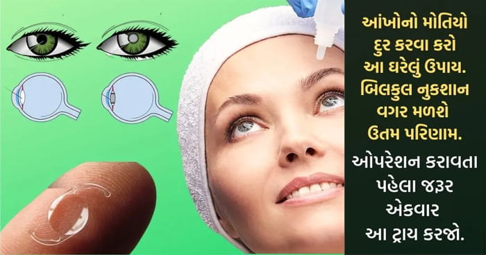 વગર ઓપરેશને ઘરેલું ઉપાય દ્વારા આંખના મોતિયો અને વેલમાંથી આજીવન છુટકારો મળવોમ, એક વાર જાણો પરિણામ જરૂર મળશે